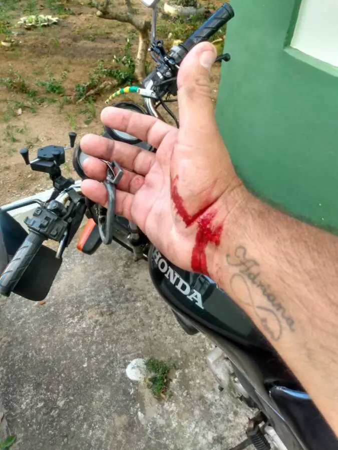 Cavalo de bicicleta e causa acidente com motociclista em Vila Velha