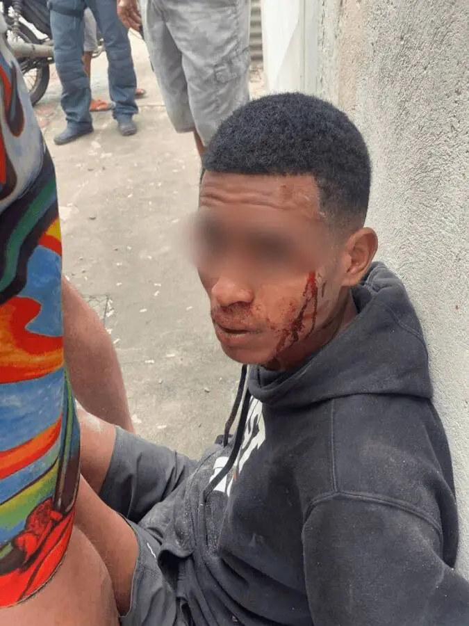 Suspeito furta padaria e depois misteriosamente aparece machucado