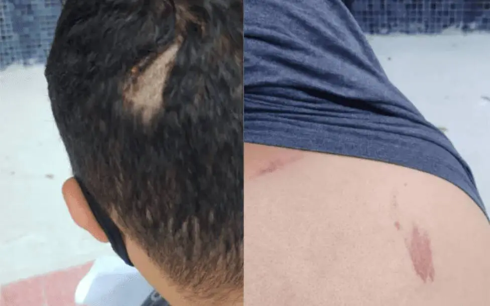 PM tenta reagir assalto, mas termina agredido em lanchonete na Serra