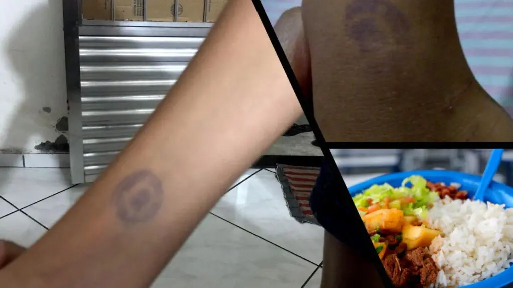 Vereador questiona prática de escola da Serra que marcou crianças com carimbo Arte com 3 imagens, na primeira e na segunda imagens o braço de uma criança marcado com um carimbo e na terceira imagem um prato de plástico com refeição