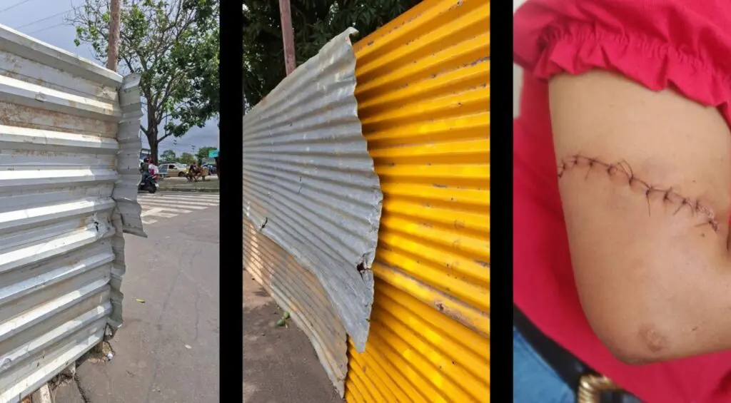 Placa de proteção e braço da pedestre com pontos