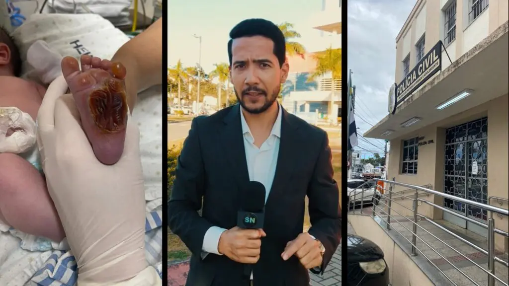 Hospital Jayme Santos Neves, na Serra, onde bebê sofreu queimadura no pé