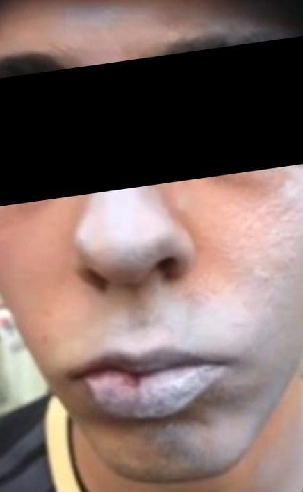 Vídeo: pichador tem o rosto pintado até os beiços e é agredido por moradores em Barcelona
