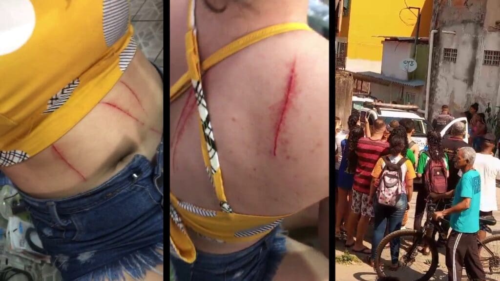 Estudante leva golpes de tesoura.