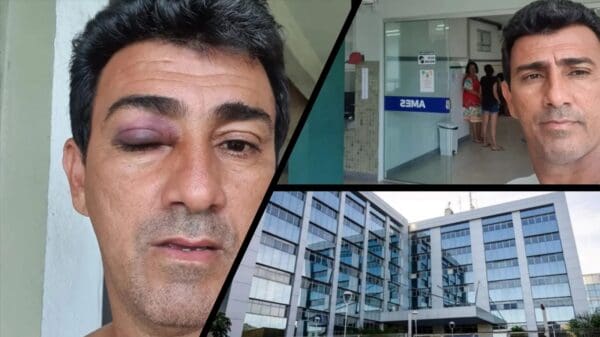 Rubens Pereira exibe olho roxo após agressões na sede da Prefeitura da Serra