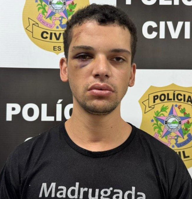 Foto de um sujeito com o olho direito roxo e inchado no momento em que a Polícia Civil, faz o registro fotográfico do detido.