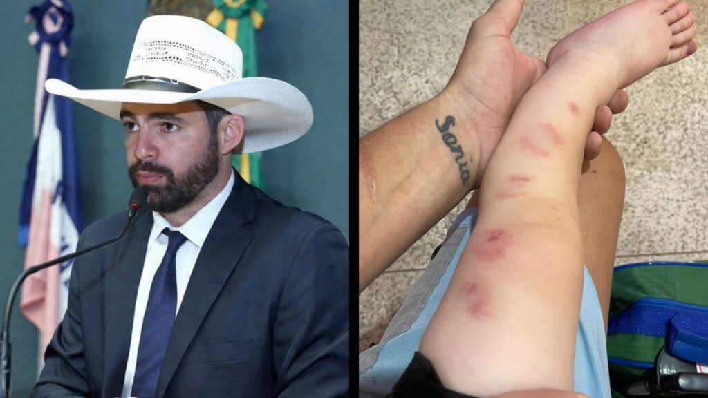 Deputado Muribeca denuncia negligência após bebê sofrer mordidas em creche da Serra